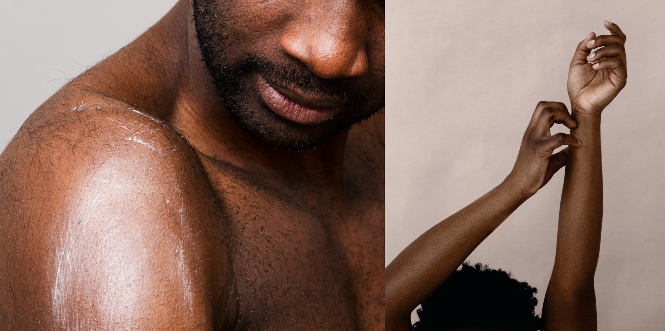 Eczema explained, part 2: Is melanin-rich skin more prone to misdiagnosis? Plus, other  myths and mistakes you need to know