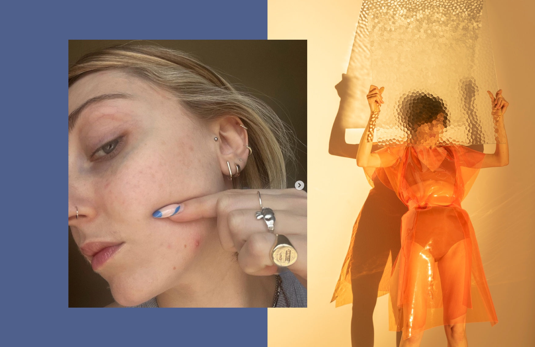Forget flawless: Here's what the founder of this revolutionary acne acceptance movement wants you to know