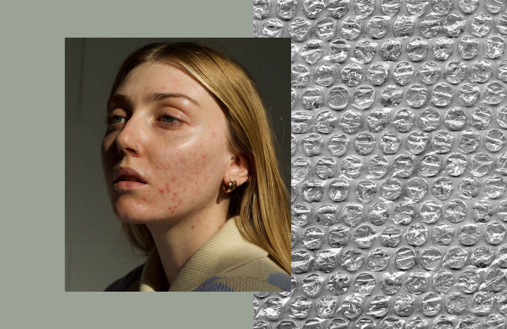 “Flawless isn’t a skin type and poreless doesn’t exist”: Meet the acne influencer changing the game
