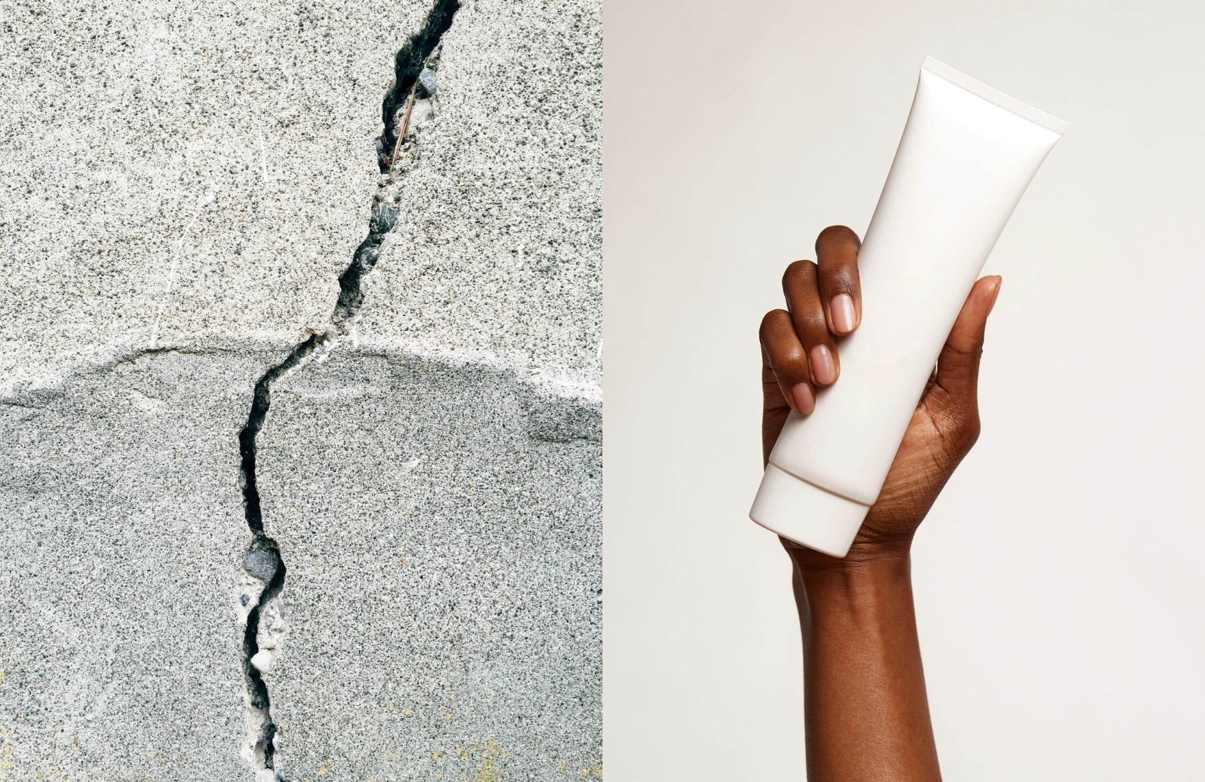 Two top dermatologists reveal how to treat acne scars once and for all