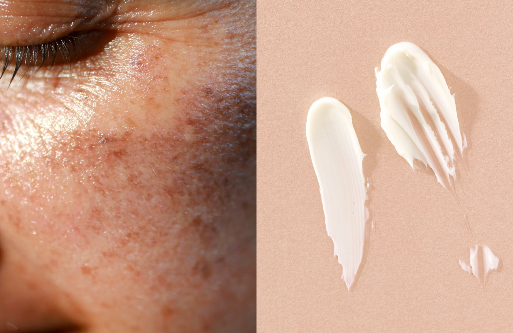 Love the benefits of retinol? Then don't skip this essential skincare step