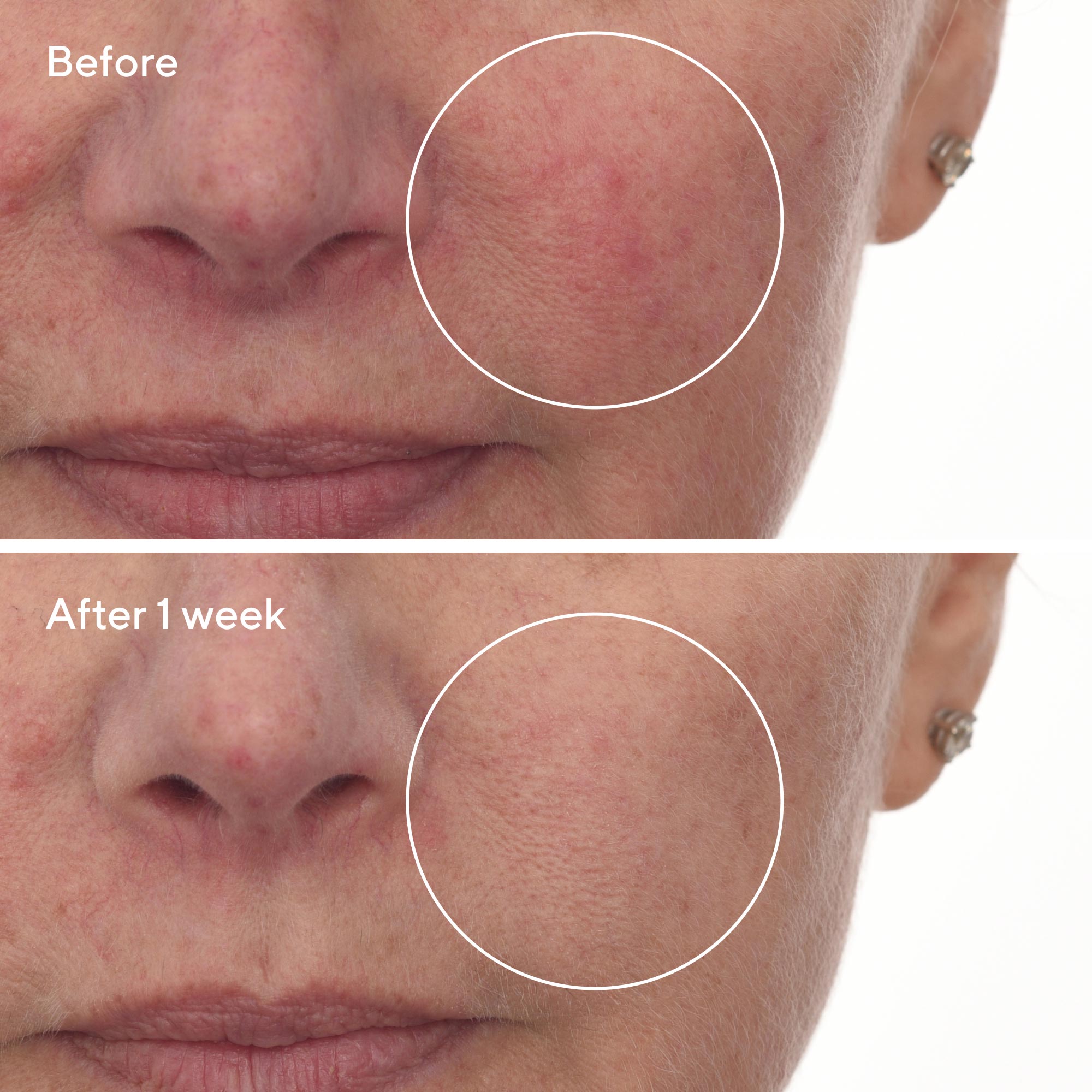 cellular hydration serum before and after
