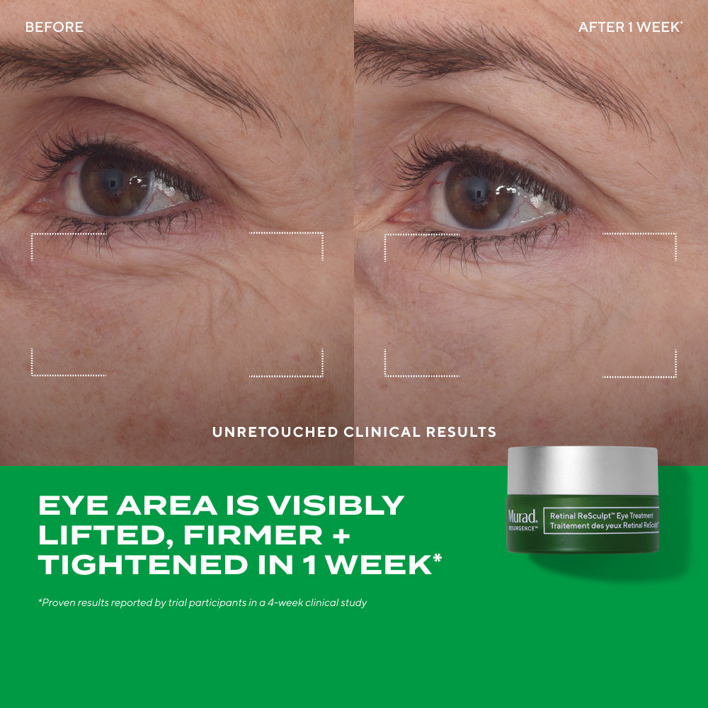 Side-by-side close-up images of the eye area labeled 'Before' and 'After 1 week.' The after image shows the outer eye area with visibly softer fine lines and reduced crow's feet compared to the before image