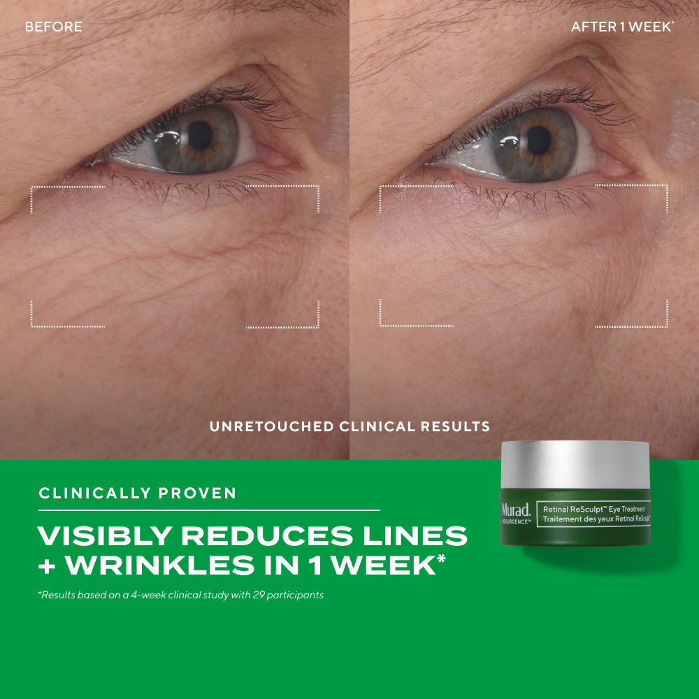 Before-and-after clinical images of the eye area showing reduced appearance of lines and wrinkles after one week, alongside Murad Retinal ReSculpt Eye Treatment.