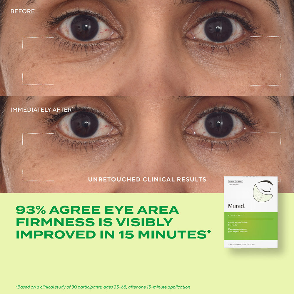 before and immediately after close up of woman's eye area with text highlighting 93% agree eye area firmness is visibly improved in 15 minutes