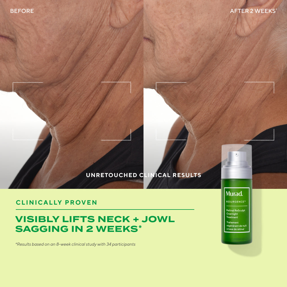 retinal resculpt overnight treatment before and after visibly lifts neck + jowl sagging in 2 weeks