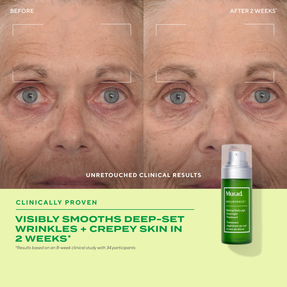 retinal resculpt overnight treatment before and after visibly smooths deep-set wrinkles + crepey skin in 2 weeks
