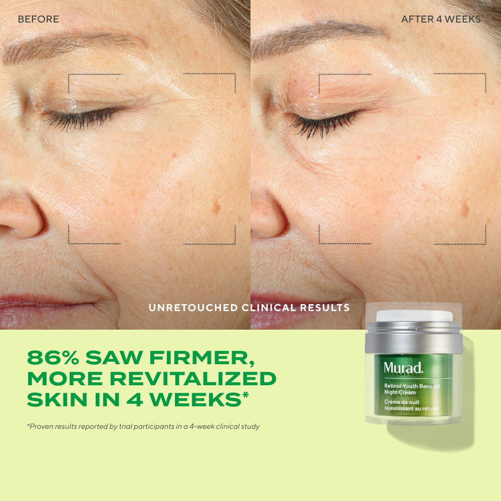 before and after of woman after 4 weeks of using Retinol Youth Renewal Night Cream with text highlighting 86% saw firmer, more revitalized skin in 4 weeks
