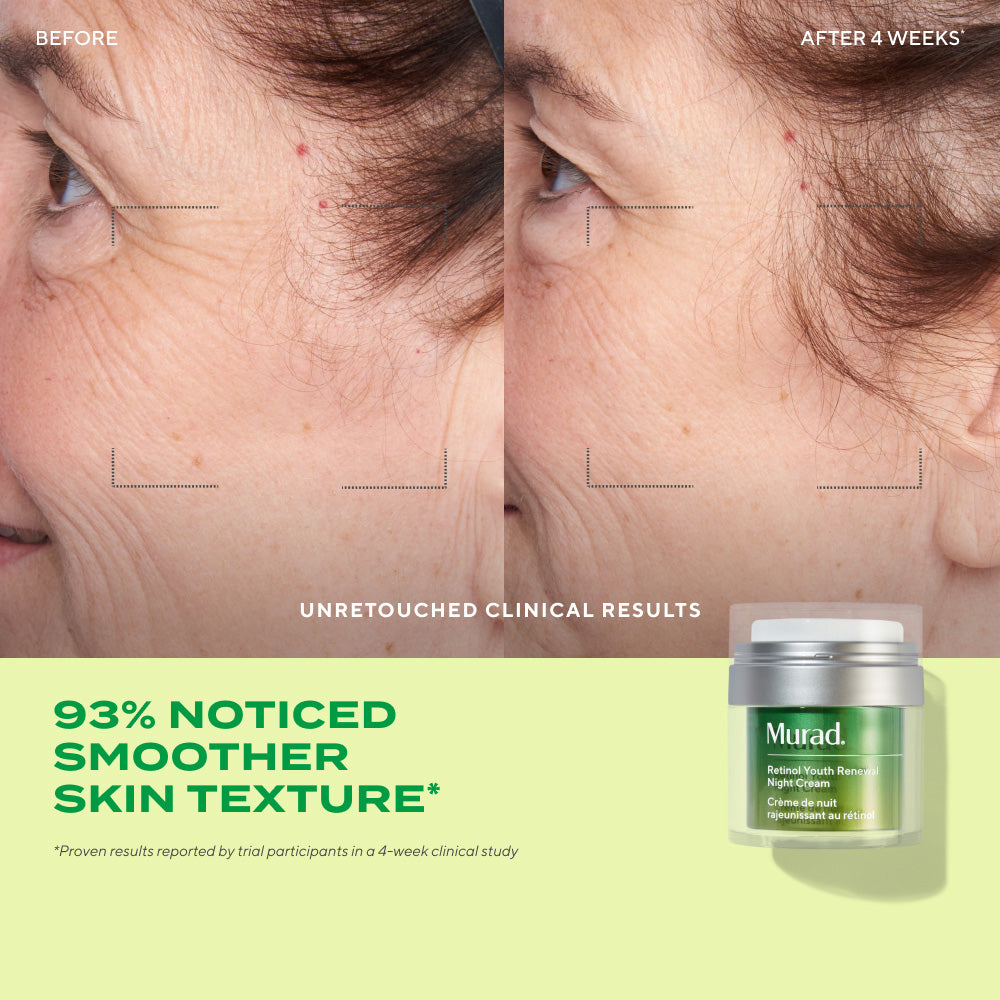 before and after of side profile of woman after 4 weeks of using Retinol Youth Renewal Night Cream with text highlighting 93% noticed smoother skin texture after 4-week clinical study