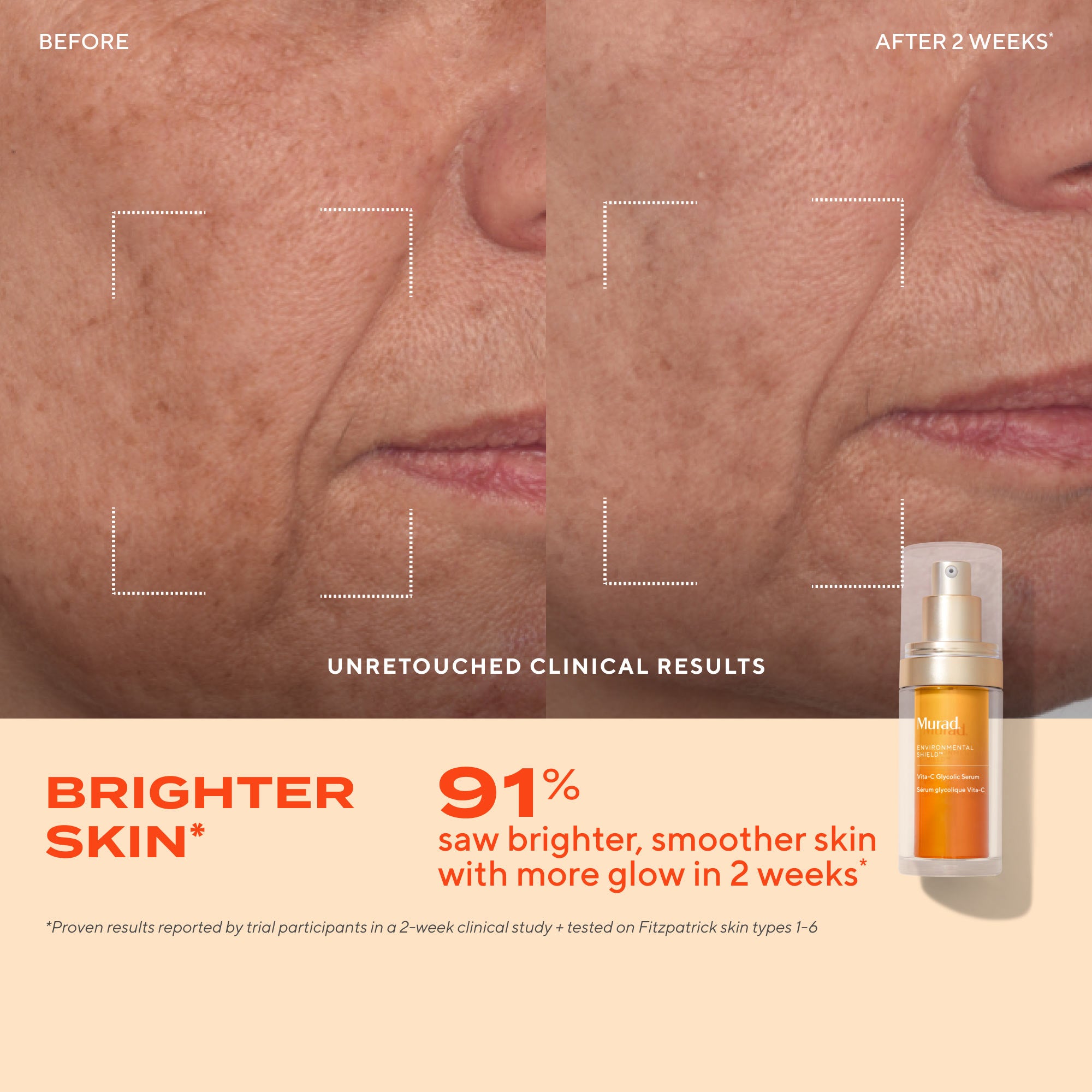 Glow Better Brightening Discovery Kit