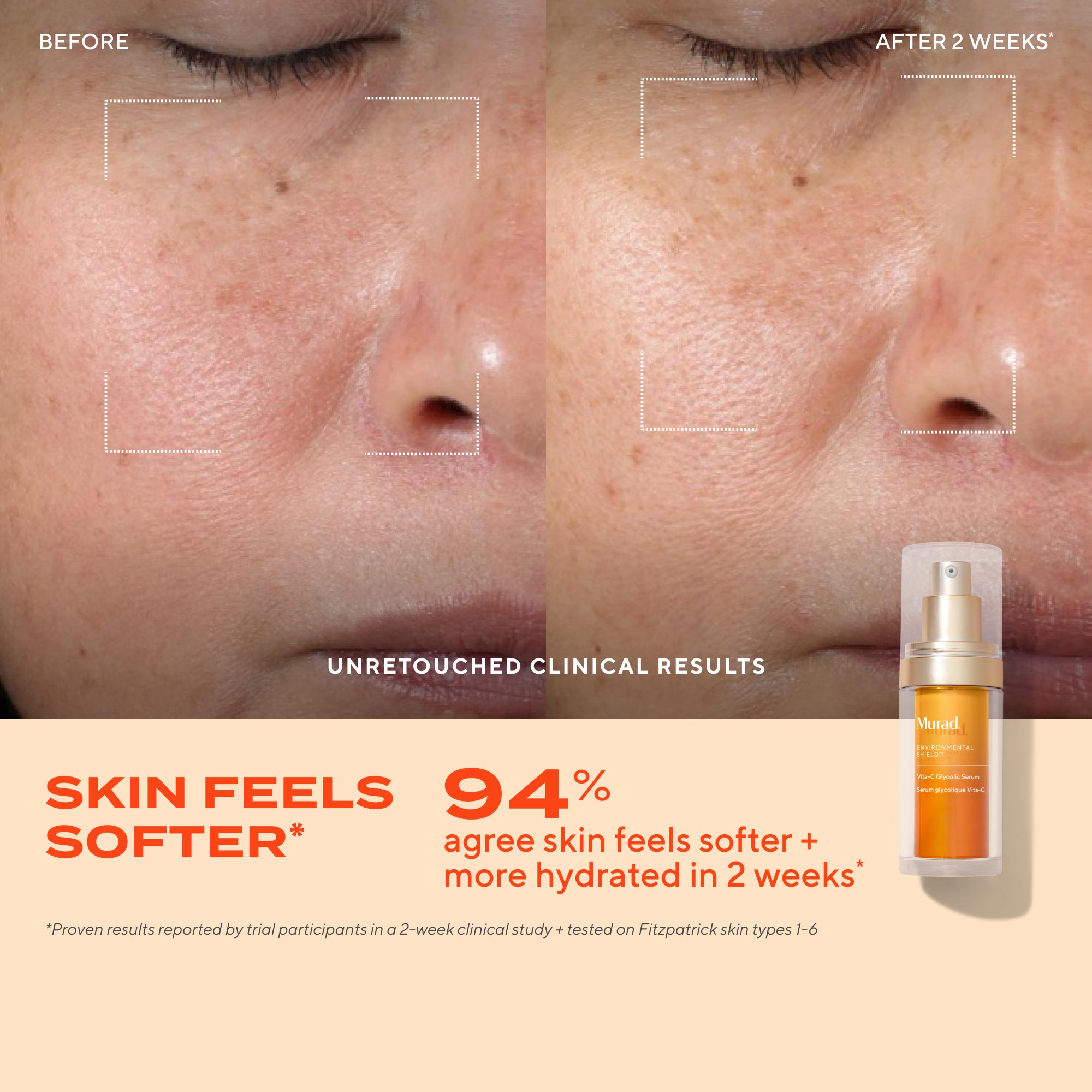 Vita-C Glycolic Serum Refill Savings Bundle