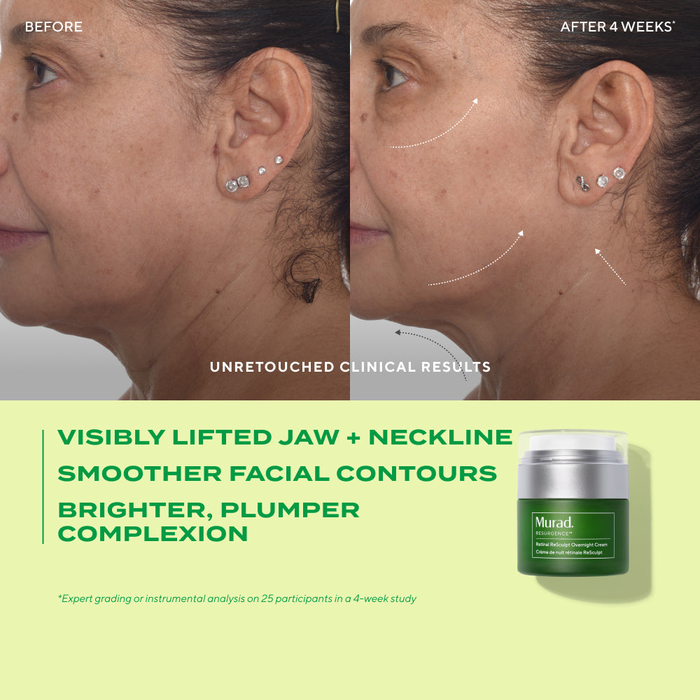 Before and after comparison of a woman's face with visible skin improvement, featuring a Murad skincare product.