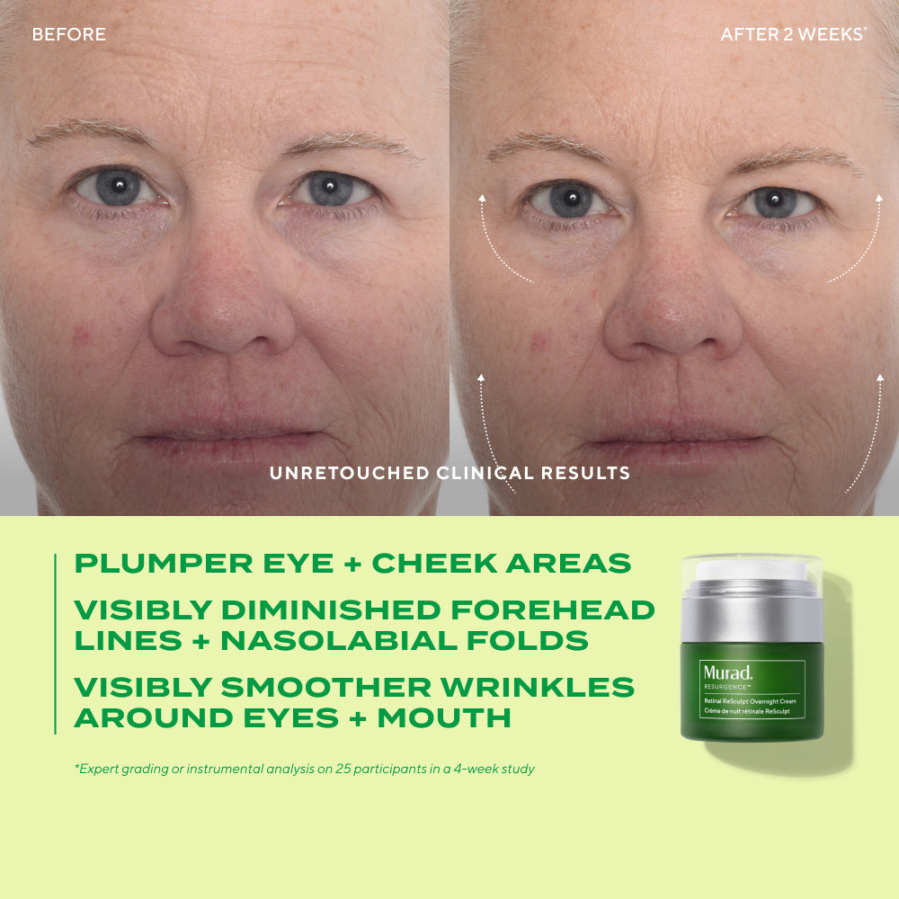Before and after comparison of a woman's face with skincare product showing visible improvements.
