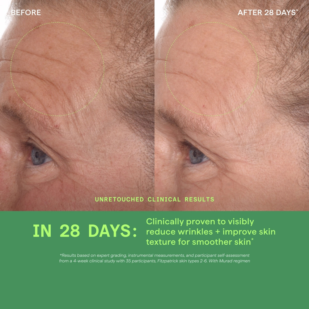 Before and after comparison of a person's face with wrinkles, showing clinical results in 28 days.