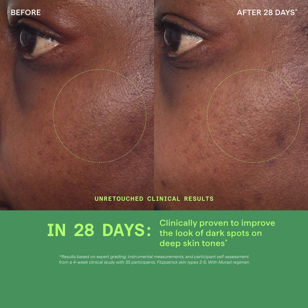 Before and after comparison of dark spots on skin with text about clinical results.
