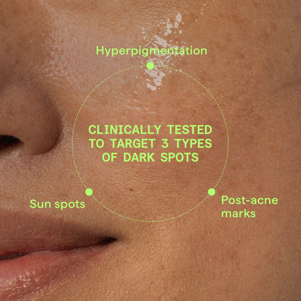 Close-up of skin with text indicating clinically tested treatment for dark spots.