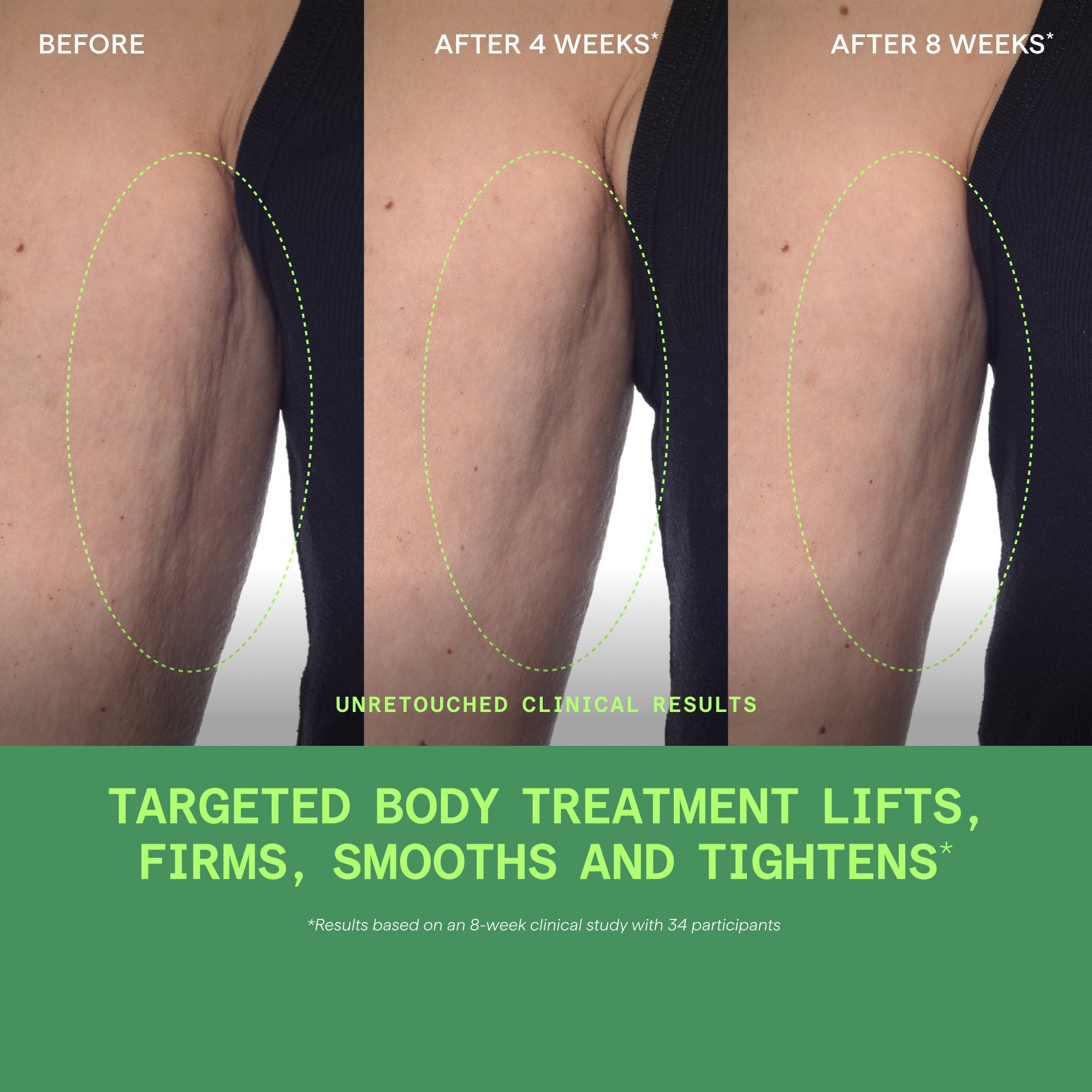 Retinal ReSculpt Body Treatment